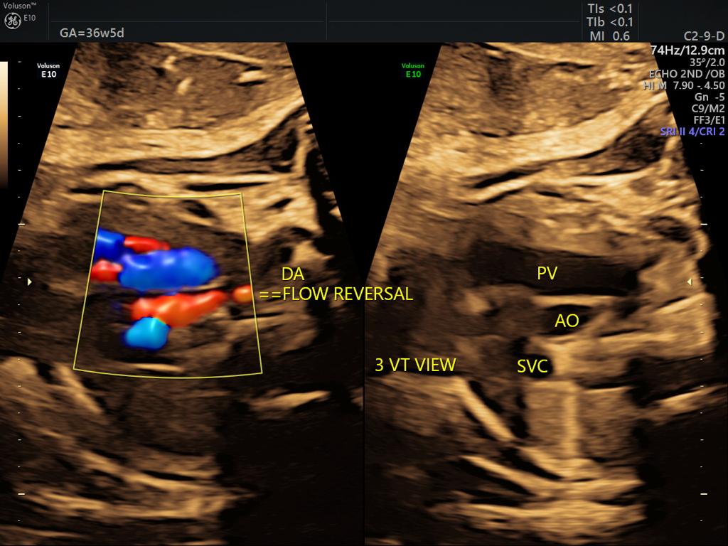 Anomaly Scan Test in Guntur