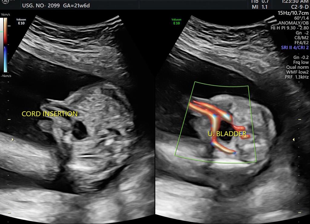 Anomaly Scan Test in Guntur