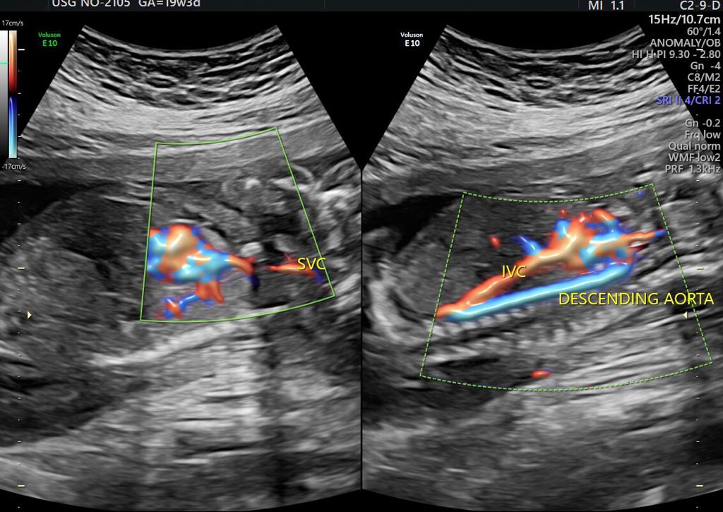Anomaly Scan Test in Guntur