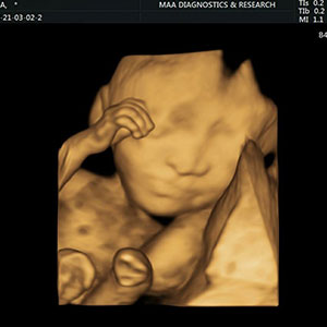 targeted scan for anomalies